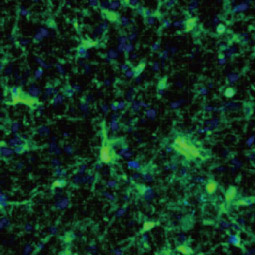 Iba1 antibody [HL22] (GTX635363)